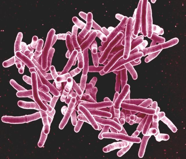 Паличка Коха – до якої групи бактерій належить, як передається, як гине?