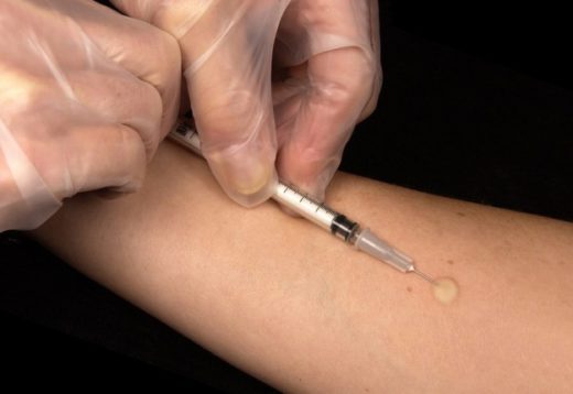 Перші ознаки пневмонії у дітей як виявити вчасно