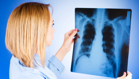 Пневмосклероз легень – що це таке: лікування і симптоми
