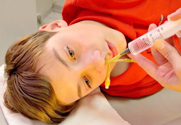 Поліпозний риносинусит – причини, симптоми, лікування