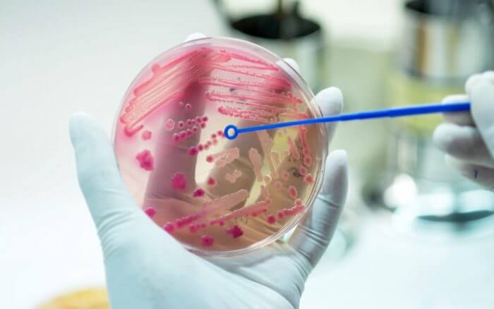 Полисегментарная пневмонія у дорослих: двостороння, лівостороння Полисегментарная пневмонія у дорослих: двостороння, лівостороння