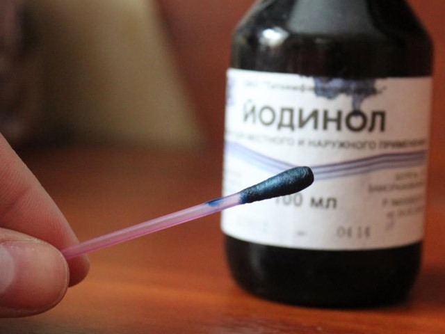 Полоскання горла Йодинол при ангіні