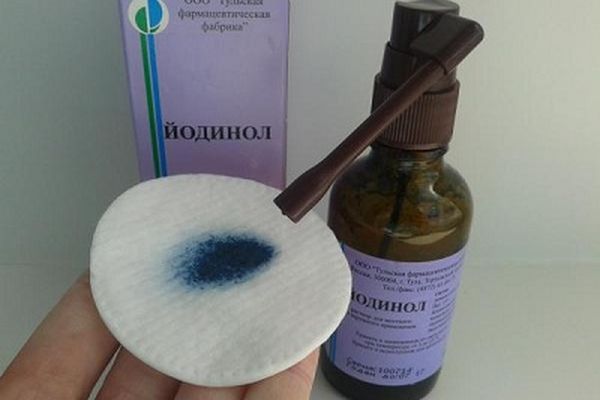 Полоскання горла Йодинол при ангіні