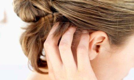Позбавитися від себореї в домашніх умовах