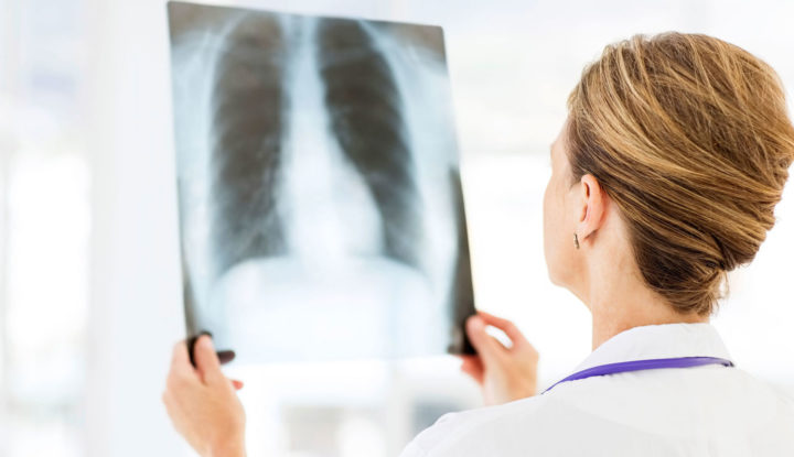 Правостороння і лівостороння прикоренева пневмонія Правостороння і лівостороння прикоренева пневмонія