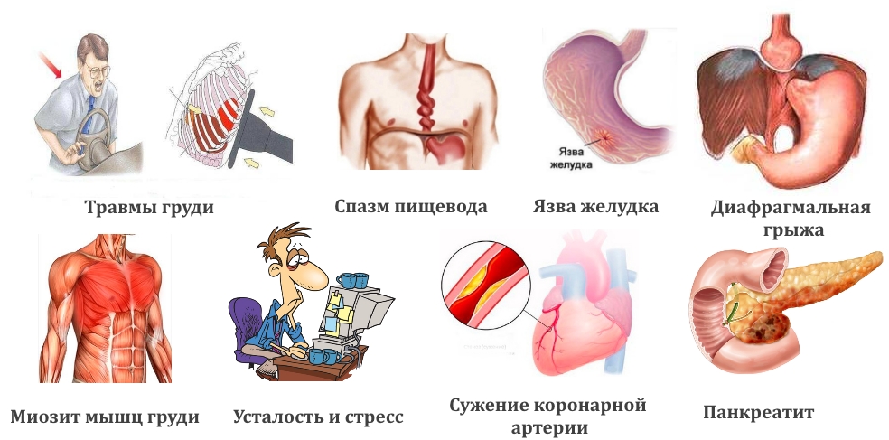 Причини і характерні ознаки спазмів у грудній клітці посередині