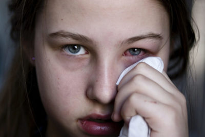 Причини і лікування болю в куточку ока ближче до носа