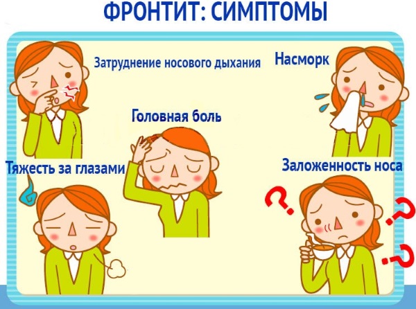 Причини і лікування гострого фронтиту