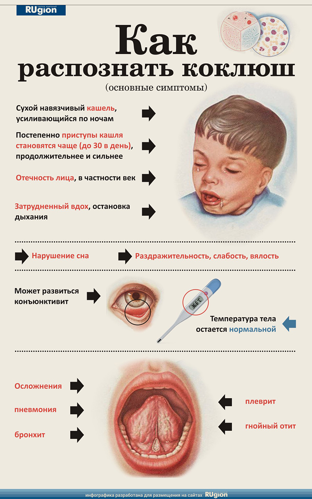 Причини і лікування нападів кашлю у дитини