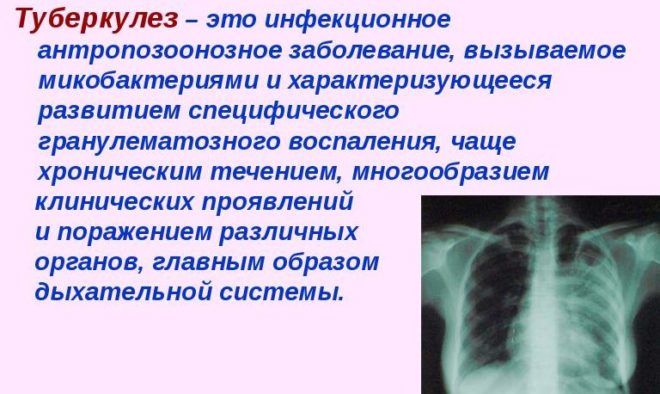 Причини і лікування сухого кашлю