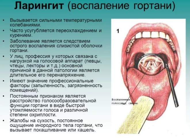 Причини і лікування сухого кашлю
