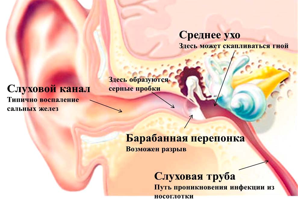 Причини і лікування вуха при запаленні