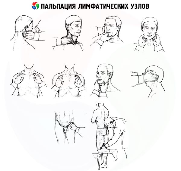 Причини і лікування збільшення підщелепних лімфовузлів у дитини Причини і лікування збільшення підщелепних лімфовузлів у дитини