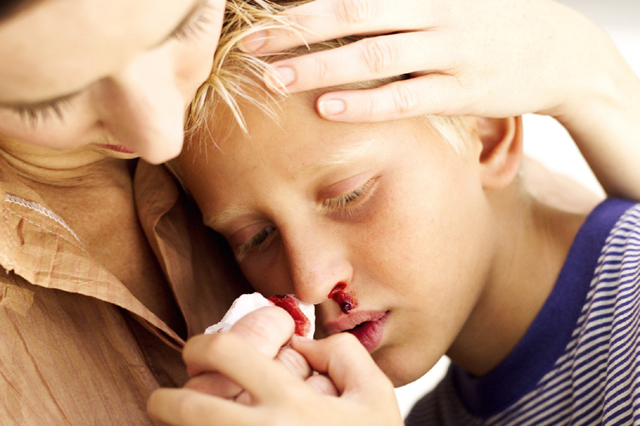 Причини носової кровотечі у дитини. Як зупинити кров з носа