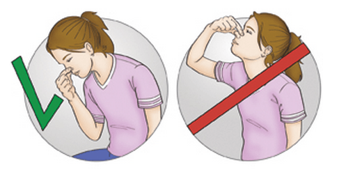 Причини носової кровотечі у дитини. Як зупинити кров з носа