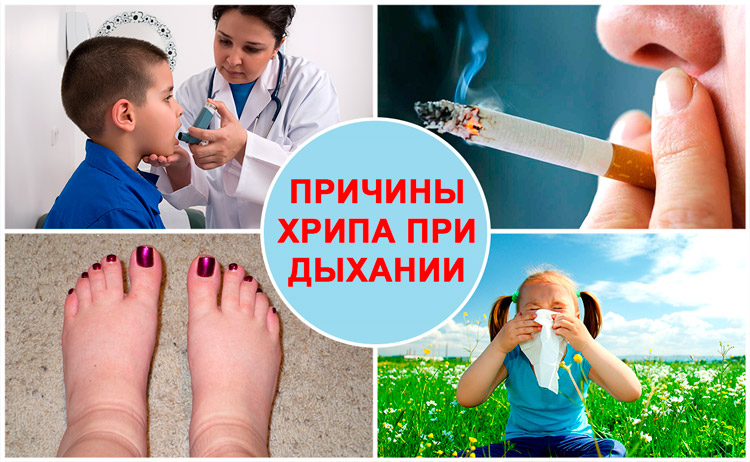 Причини появи хрипів у горлі
