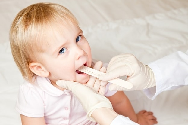 Причини розвитку герпесного фарингіту і способи його лікування