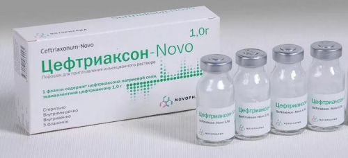 Причини симптоми і лікування алергічного уретриту