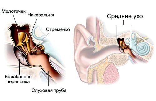 Причини симптоми і лікування отиту у дитини в домашніх умовах