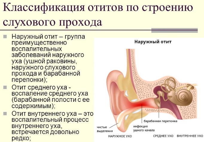 Причини симптоми і лікування отиту у дитини в домашніх умовах