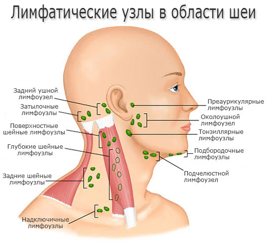 Причини симптоми і лікування запалення лімфовузлів при застуді