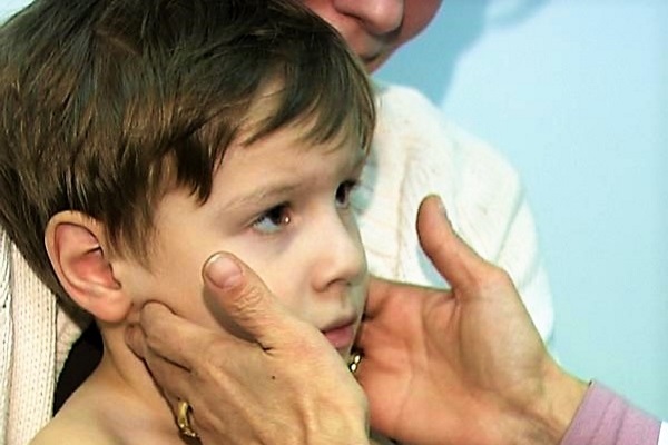 Причини симптоми і лікування запалення лімфовузла за вухом у дитини