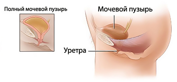 Причини утрудненого сечовипускання у жінок