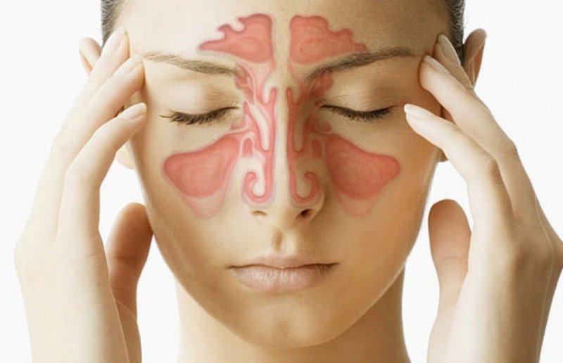 Причини види лікування і профілактика утворень на шкірі носа