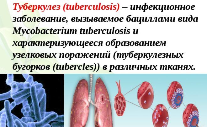 Про що говорить чорна мокротиння при кашлі