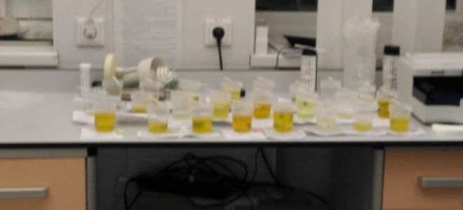 Про що говорить кров у сечі у жінок Про що говорить кров у сечі у жінок