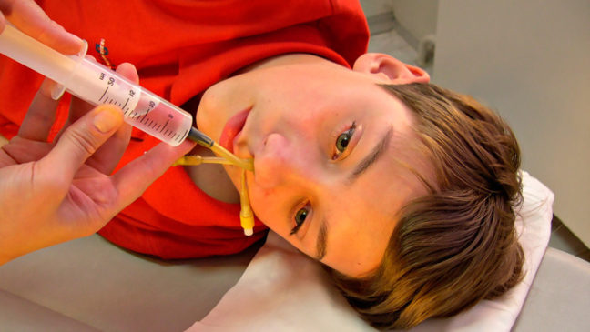 Процедура ямик при гаймориті Процедура ямик при гаймориті