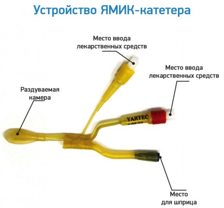 Процедура ямик при гаймориті Процедура ямик при гаймориті