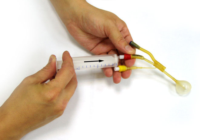 Процедура ямик при гаймориті Процедура ямик при гаймориті