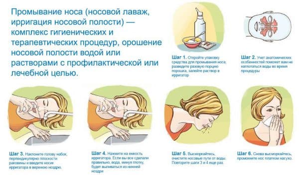 промивати ніс при гаймориті правильно. Важливі рекомендації