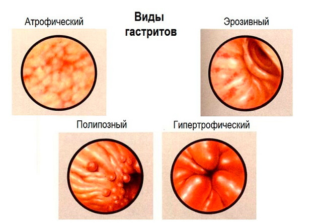 Прополіс для схуднення як приймати