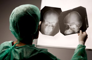 Пухлина носа види симптоми причини