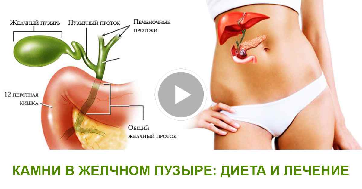 Розчинити камені в жовчному міхурі народні засоби перевірені