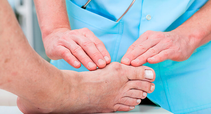 Що не можна їсти при подагрі і що можна список продуктів і таблиця