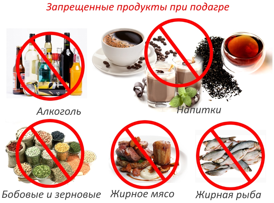 Що не можна їсти при подагрі і що можна список продуктів і таблиця