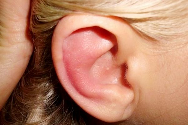 Що потрібно знати про алергічному отиті у дорослих у дітей