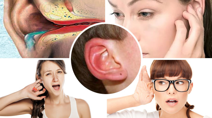 Що потрібно знати про алергічному отиті у дорослих у дітей