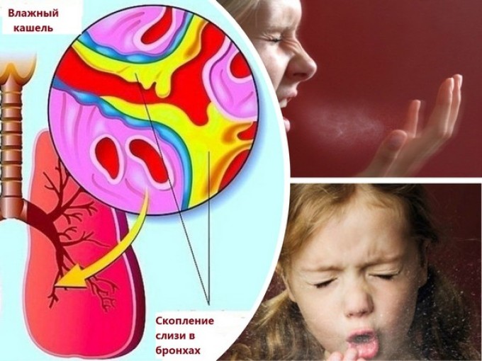 Що робити якщо сильний мокрий кашель без температури у дитини