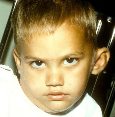 Що таке мастоїдит особливості симптоми лікування і прогноз Що таке мастоїдит особливості симптоми лікування і прогноз