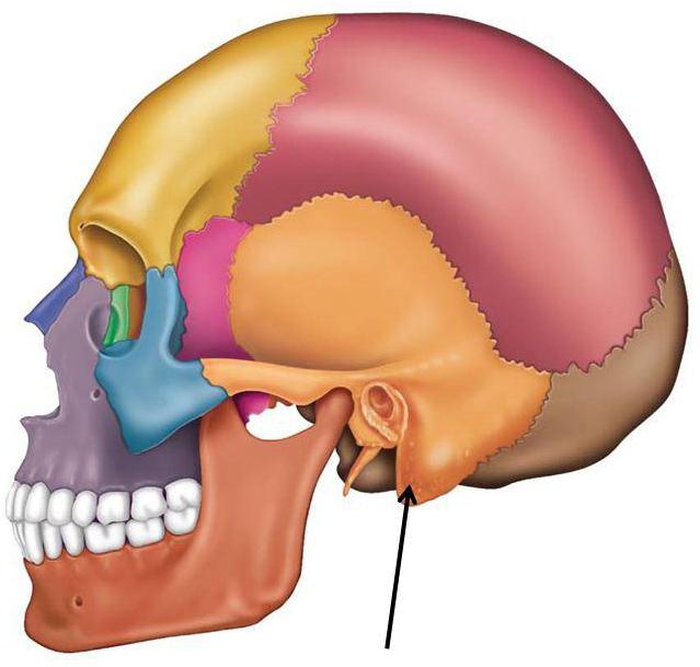 Що таке мастоїдит особливості симптоми лікування і прогноз Що таке мастоїдит особливості симптоми лікування і прогноз