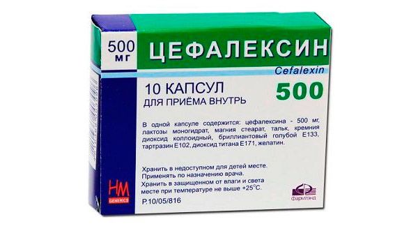 Сфеноидит як виявити і лікувати це захворювання