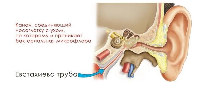 Шум у вухах після застуди народними засобами Шум у вухах після застуди народними засобами