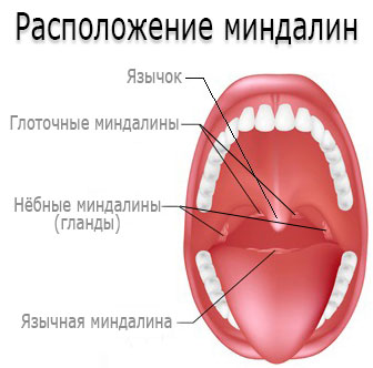 Симптоми фолікулярної ангіни а також медикаментозне народне і хірургічне лікування