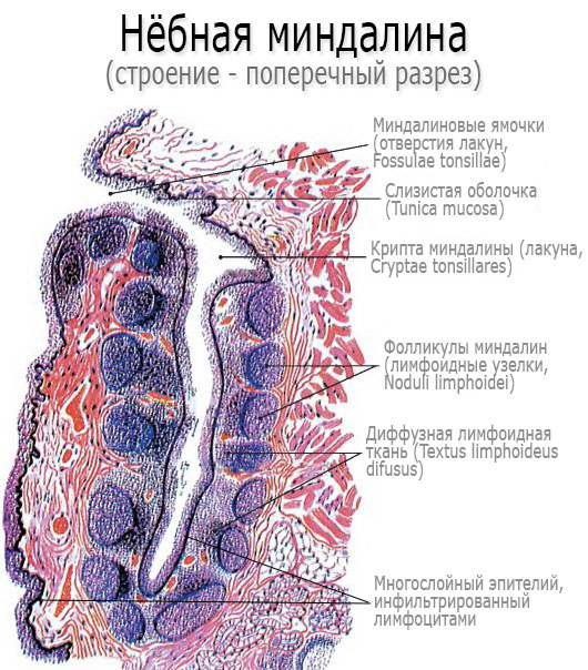 Симптоми фолікулярної ангіни а також медикаментозне народне і хірургічне лікування