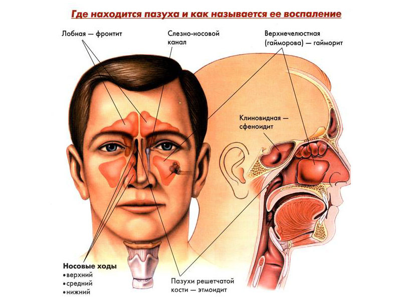 Симптоми гаймориту у дитини лікування дітей