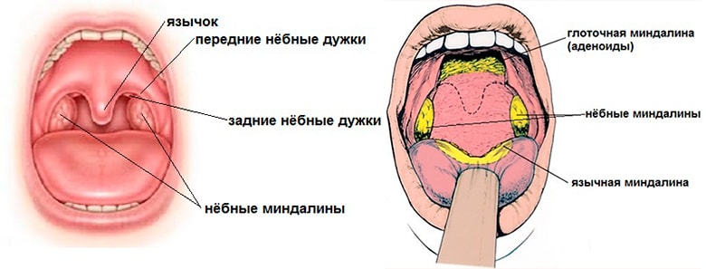 Симптоми хронічного тонзиліту у дорослих
